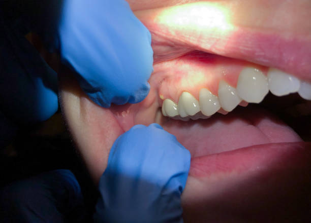 Best Tooth Infection Emergency Dentist  in New Bern, NC