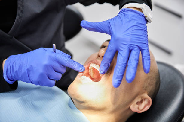 Best Chipped Tooth Repair Near Me  in New Bern, NC